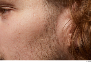 HD Arvid cheek face hair skin pores skin texture 0001.jpg